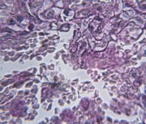 Autoteste em domicílio é alternativa para o diagnóstico sigiloso de ISTs