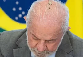 Lula passa por novas sessões de radioterapia no couro cabeludo