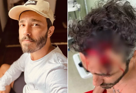 Ator tem parte do couro cabeludo arrancada ao ser espancado durante assalto
