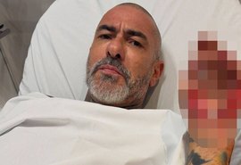 Fogaça revela que quase morreu em acidente de moto: 'Peguei óleo na pista'