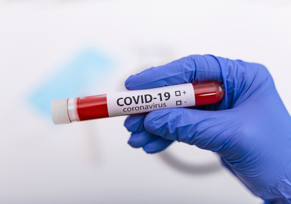 Alagoas registra 969 novos casos de covid-19 e 20 mortes neste sábado (12)