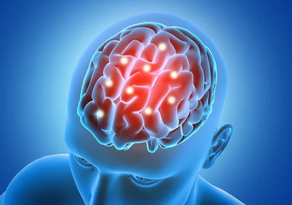 Marcapasso cerebral ajuda no tratamento do Parkinson e do TOC grave