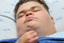 Gordão da XJ realiza processo cirúrgico delicado após perder mais de 130 kg