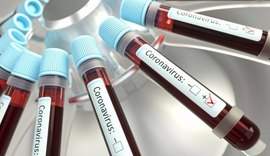 Alagoas registra hoje mais 12 mortes pela Covid-19