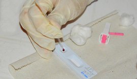 Casos de HIV em Alagoas aumentam 11,89% em 2024