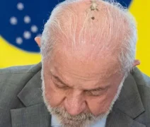 Lula passa por novas sessões de radioterapia no couro cabeludo