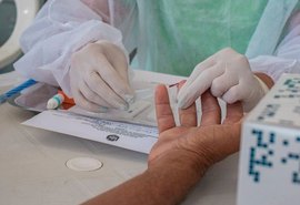 Quase 700 casos de HIV são registrados em AL