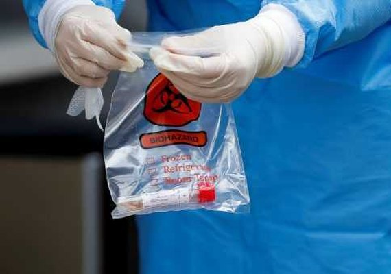 Brasil tem 56.197 óbitos e 1.284.214 casos confirmados de Covid-19