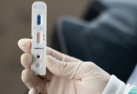 Municípios precisam comprovar uso de testes rápidos para solicitação de novos lotes