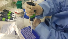 Exame para identificar Zika vírus é comercializado no país