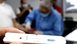 Servidor com covid-19 pode pedir carência no pagamento do consignado