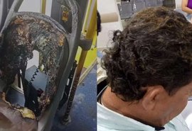 Criminosos ateiam fogo em ônibus e motorista fica ferido