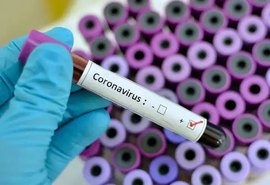 Alagoas confirma 243  casos de Covid-19 e 20 mortes