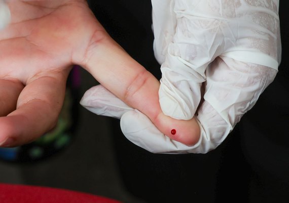 SUS oferece teste rápido de dengue em todo o país