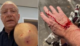 Jornalista da Globo leva 4 pontos na mão após ataque de Pitbull sem guia