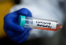 Pesquisadores encontram anticorpo que neutraliza coronavírus