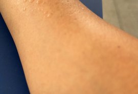 Aulas sob calor infernal: Professor denuncia descaso com alunos em escola de Maceió