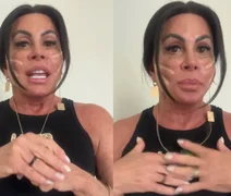 Gretchen revela novo procedimento com fios de sustentação no rosto