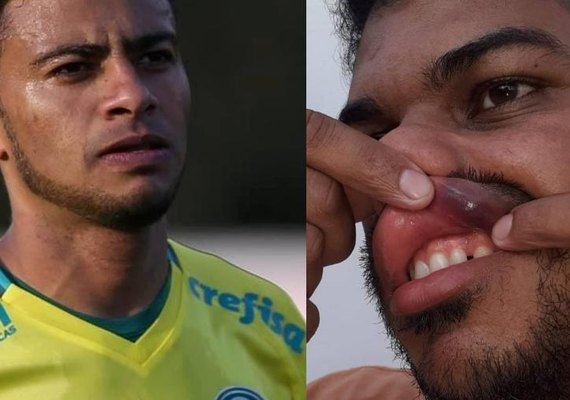 Ex- jogador do Palmeiras é denunciado por agressão em Alagoas