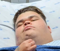 Gordão da XJ realiza processo cirúrgico delicado após perder mais de 130 kg