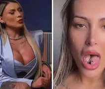 Andressa Urach alerta sobre bifurcação na língua: 'Prejudicou minha dicção”