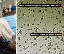 MC Cabelinho revela congelamento de sêmen após vasectomia