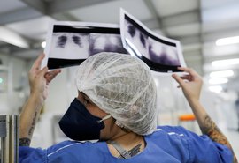 Diagnóstico tardio reduz chances de cura do câncer de pulmão