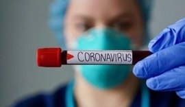 COVID-19: Veja vídeo com formas de prevenção