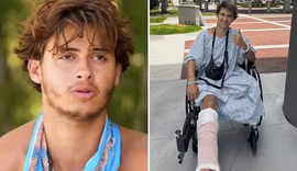 Ex-participante de reality pede R$ 510 milhões após perder perna em acidente