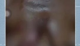 Mulher é atacada com óleo quente pelo companheiro em Mata Grande