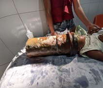 Menino de 2 anos é resgatado após ficar com a cabeça presa em tubo de metal em AL