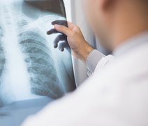 Anvisa aprova novo medicamento para câncer de pulmão avançado