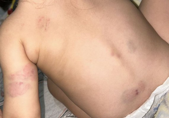 Mulher é presa por agredir filha de dois anos em Coité do Nóia