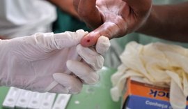 Alagoas deve realizar exames em paciente com hepatite B