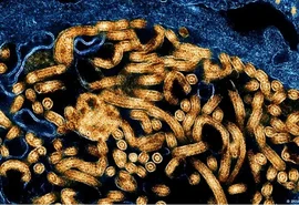 OMS confirma primeira recuperação de paciente no atual surto de ebola no Congo