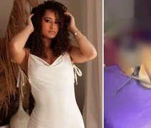 Mulher resgatada de cativeiro relata abusos e queimaduras com ácido na boca