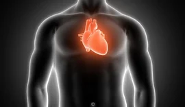 Estudo detecta microplásticos no sangue de vítimas de infarto