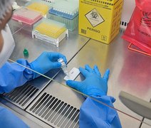 Anvisa atualiza regras para controle de qualidade em laboratórios