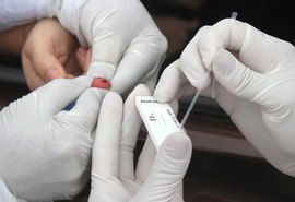 Arapiraca não registra óbitos por Covid-19 há mais de 10 dias