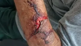 Mulher é presa suspeita por roubo e agressão de idoso em Alagoas