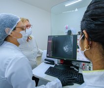 Uncisal disponibiliza 5 mil exames de mamografia até o fim do ano