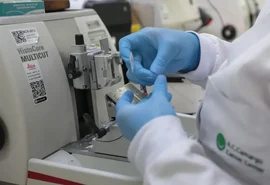 Cura do câncer de próstata pode alcançar 98%, aponta especialista da Sociedade Brasileira de Urologia