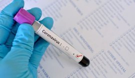 Brasil tem mais de 1 milhão de casos confirmados de Covid-19