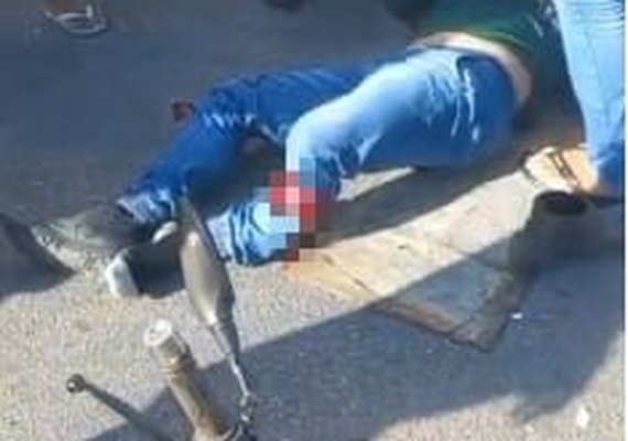 Motociclista sofre fratura exposta após colisão com caminhão em Rio Largo