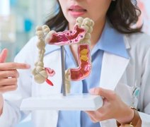 Câncer colorretal: informação e prevenção são aliados no diagnóstico precoce