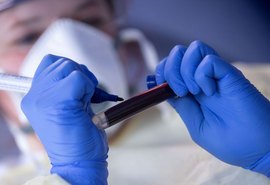 Teste para covid-19 sai da lista obrigatória de cobertura dos planos de saúde