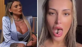 Andressa Urach alerta sobre bifurcação na língua: 'Prejudicou minha dicção”