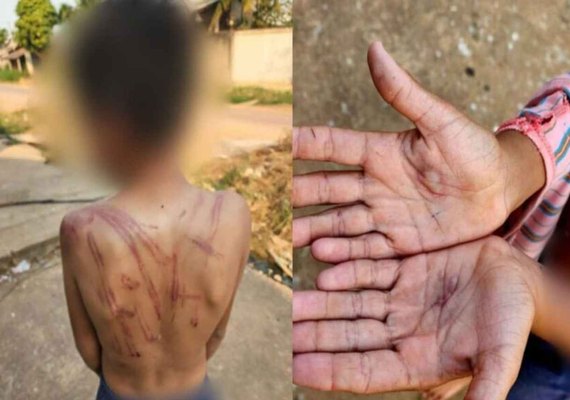 Mãe espanca e queima mãos de filho com isqueiro por causa de 10 reais