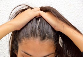 Dermatologista da Sesau explica a diferença entre queda de cabelo e calvície