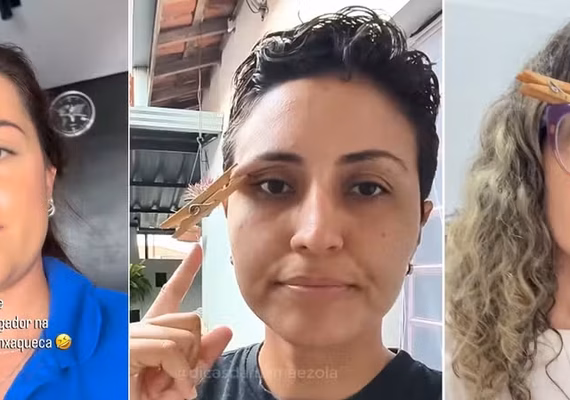 Pregador na sobrancelha alivia enxaqueca? Especialistas explicam